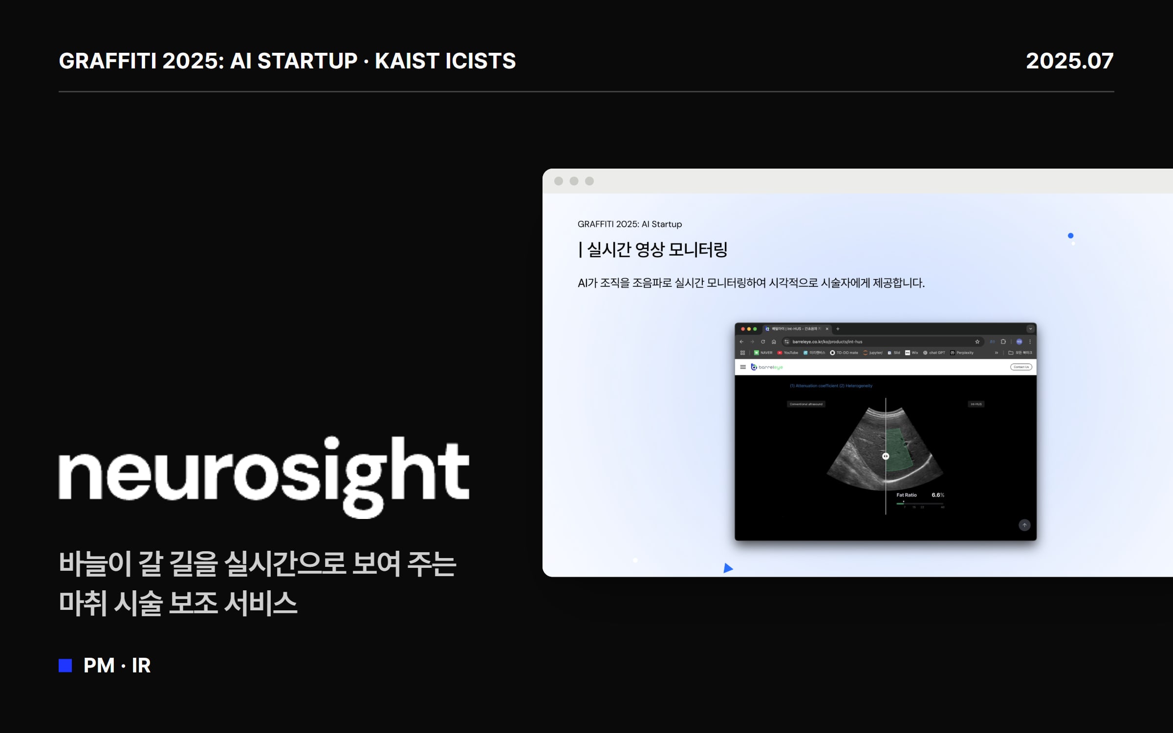 NeuroSight 1