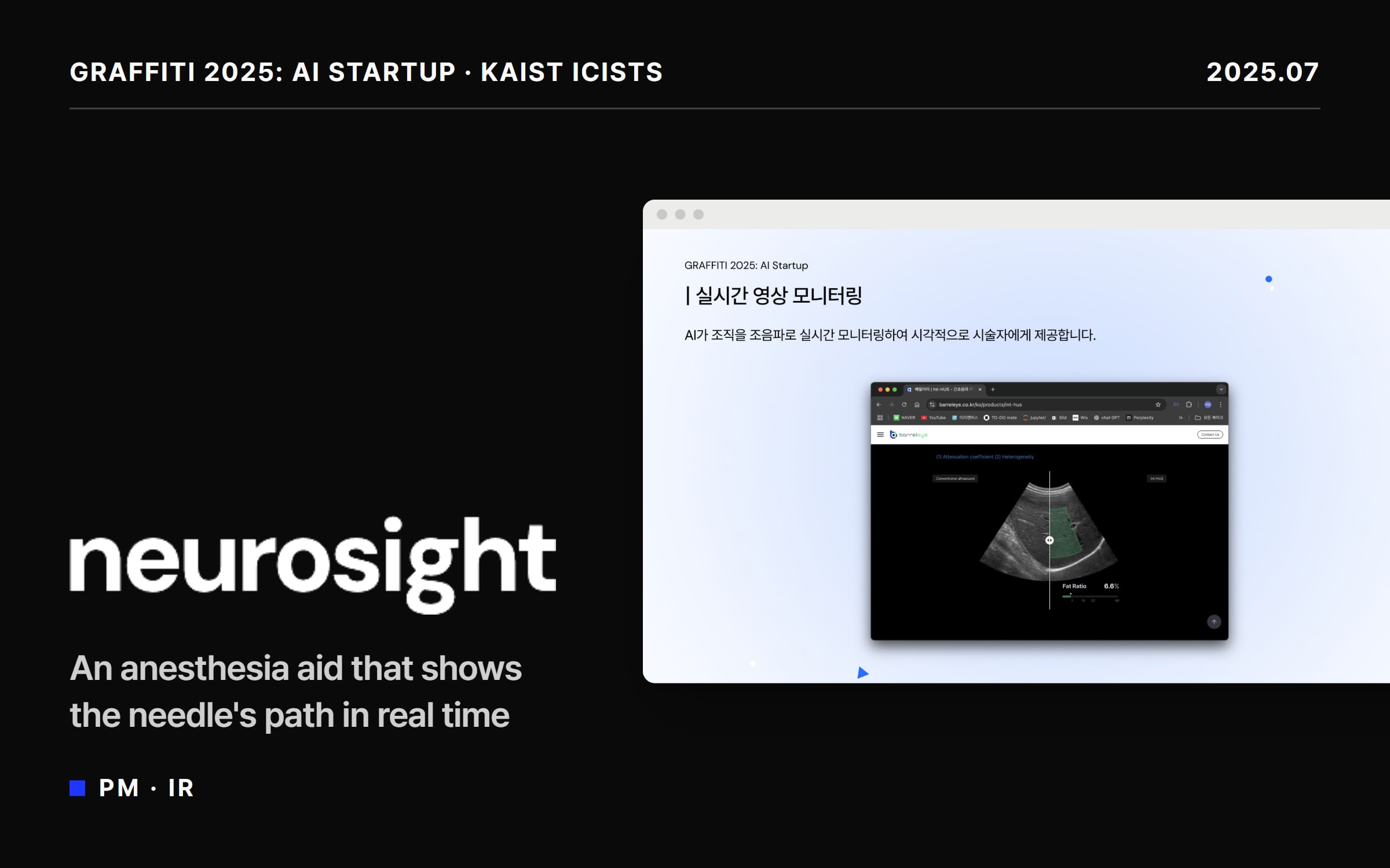 NeuroSight 1